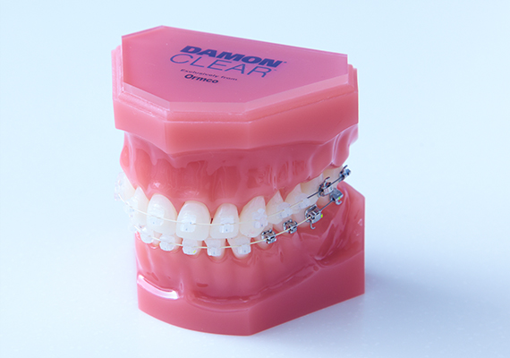 Our aesthetic line of braces features Damon® Clear™, a premium line of ceramic braces renowned for its exceptional quality, comfort and aesthetics. Its self-ligating properties ensure speed and comfort during treatment. This may also be combined with our premier range of aesthetic bio-polymer-coated wires, which have anti-bacterial properties, and are much more resistant to flaking.