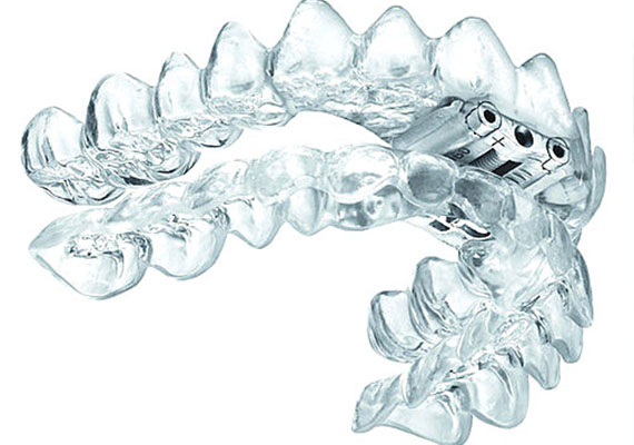 Dental Sleep Appliances are special dental splints that are used in the management of mild to moderate obstructive sleep apnoea (OSA). Our specialists work with other doctors, trained in sleep medicine, in the management of OSA. A sleep study is often necessary prior to starting any form of dental sleep appliance therapy.
