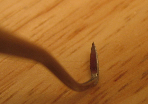 Hard, cement-like deposits, called calculus (or tartar), form around and between teeth, as a result of long-term bacterial buildup, and may lead to gum recession and bone loss over time, if not removed professionally. Arrange for a dental checkup every 6 months to avoid such problems from happening.